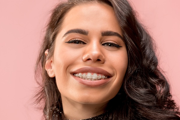 Clear Braces: A Discreet Way To Straighten Your Smile