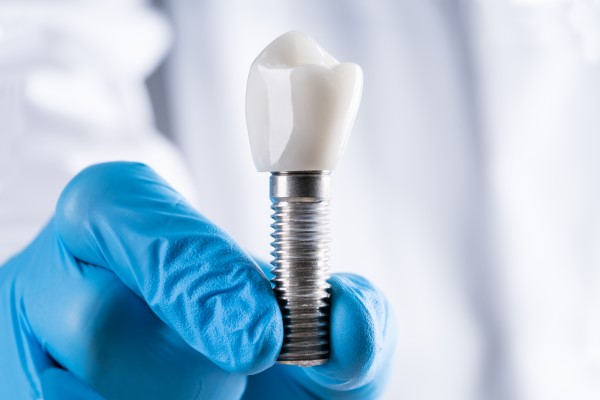 Questions To Ask When Considering A Dental Implant For A Missing Tooth
