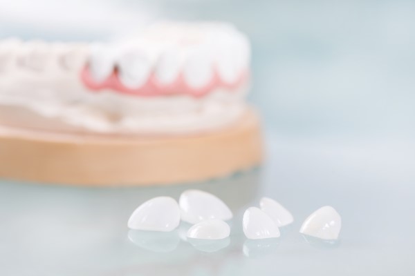 Dental Veneers Are A Solution For Chipped Teeth