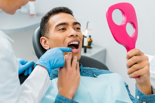 Dental Fillings and its Lifespan