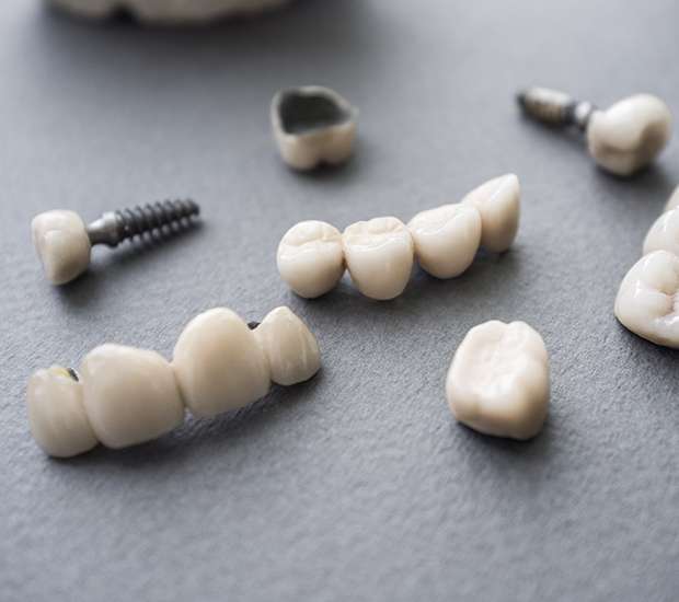 Hackensack The Difference Between Dental Implants and Mini Dental Implants